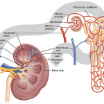 Renal denervation